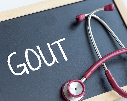 Top Signs You May Want to See a Doctor for Gout